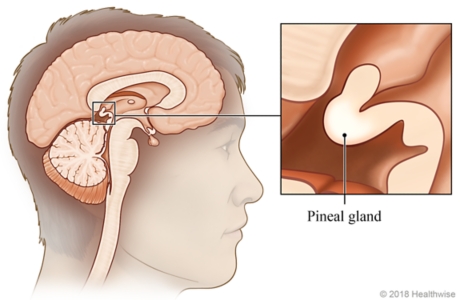 Location of pineal gland in brain, with close-up of pineal gland