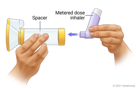 Inserting inhaler into end of mask spacer.