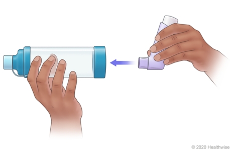 Child attaching mouthpiece of metered-dose inhaler to end of spacer.