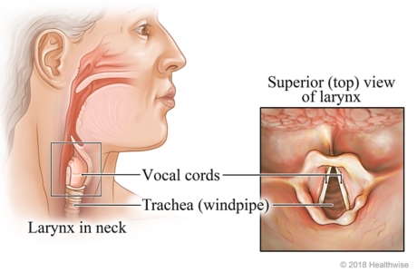 Location of larynx (voice box) in neck, with top-view detail of voice box, vocal cords, and windpipe