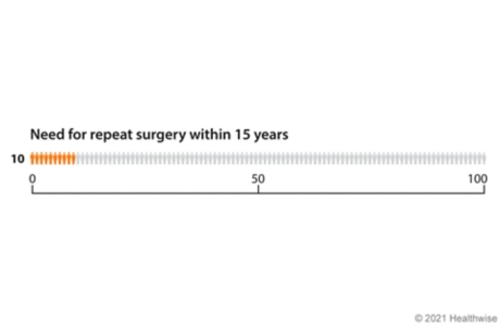 Graph with 100 figures, showing 10 figures coloured to represent how many need repeat hip replacement surgery within 15 years.