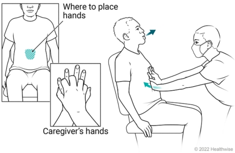 Caregiver doing abdominal thrust assist to person sitting in chair, showing hands on belly above navel with fingers interlocked and pushing up and in.