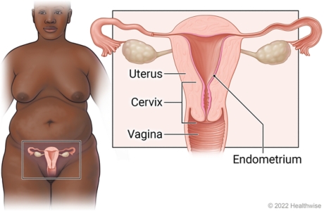 Female reproductive organs in pelvis, with close-up of uterus, endometrium, cervix, and vagina.