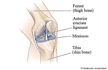 Picture of the anterior cruciate ligament (ACL)