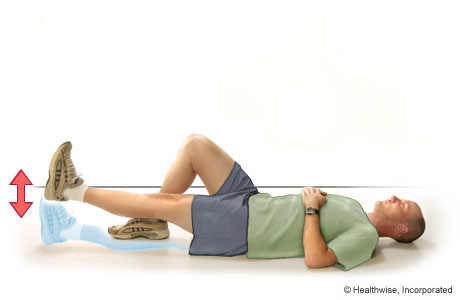 Patellar Tracking Disorder: Exercises