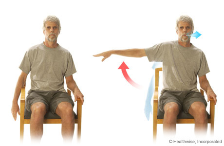 Picture of the arm-extension exercise for COPD