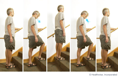 Picture of step-up exercise for COPD