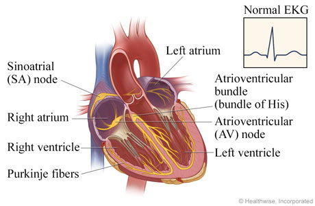 The heart and the pathways for electrical impulses, with normal EKG results