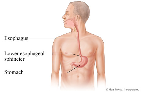 Picture of the esophagus.