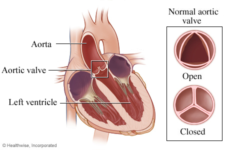 Location of aortic valve in heart and detail of open and closed valve.