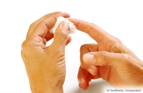 Putting pressure on fingertip to stop bleeding