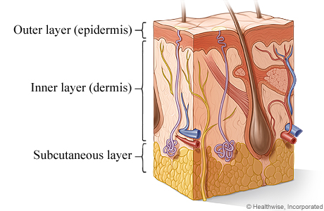 Cross section of the skin.