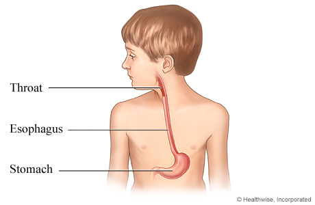 Picture of esophagus in child.