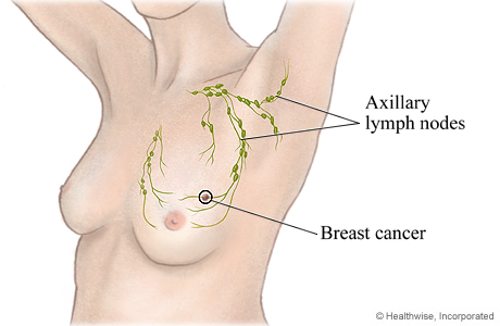 Axillary lymph nodes and where they are located