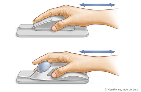 Proper hand and wrist position.