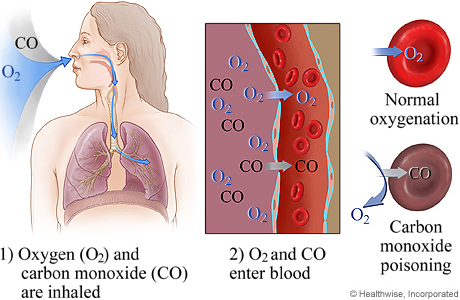 Picture of what happens in blood cells during carbon monoxide poisoning