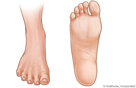 Pictures of right foot.