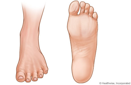 Pictures of left foot.
