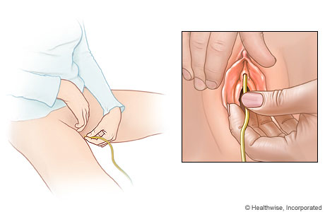 A catheterization position for women