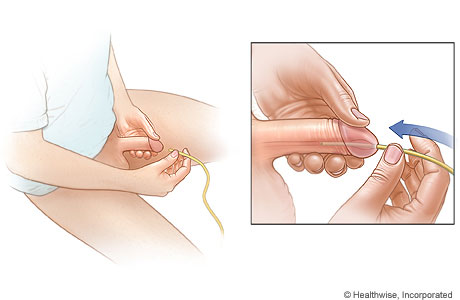 A catheterization position for men