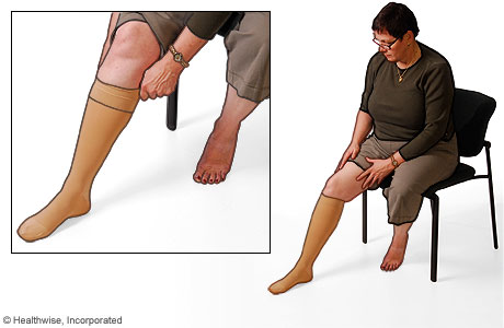 Picture of the proper use of compression stockings: Step 4
