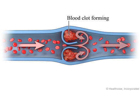 Normal venous blood flow (cross-section)