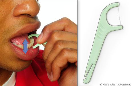 Flossing tool and photo of man using one.