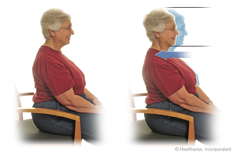 Seated exercise: Chin tuck (or dorsal glide)