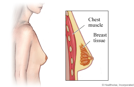 A Trussler Md Breast Surgery