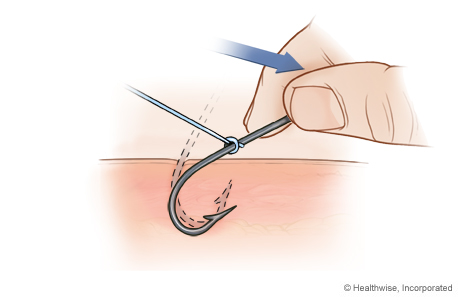 Step B: Hold hook with fingers and press down