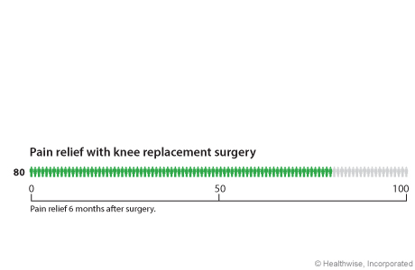 Out of 100 people who have knee replacement surgery, 80 have pain relief within 6 months after surgery.