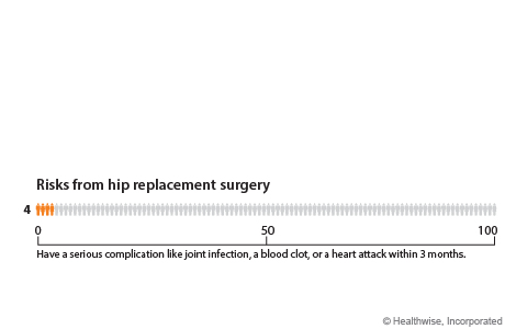 Chart of risks from hip replacement surgery