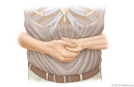 Picture A: Front view of position of hands for Heimlich manoeuvre in an adult or child
