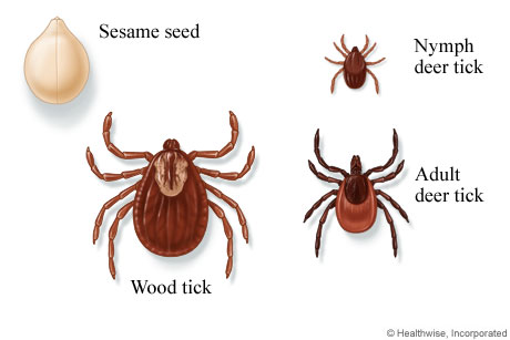 Wood and deer ticks.