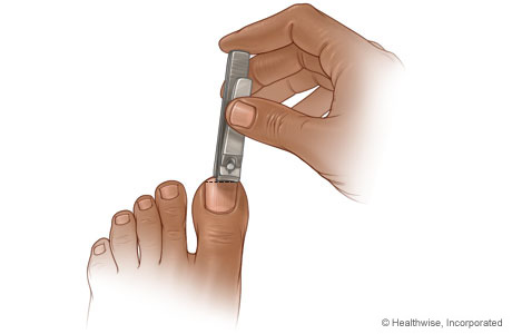 Picture of how to cut toenails
