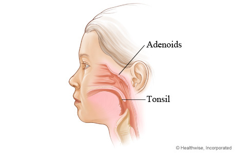 Location of tonsils and adenoids