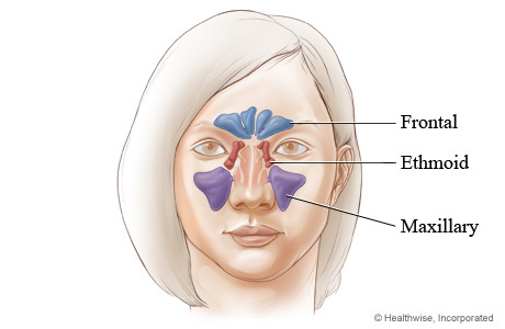Where facial sinus cavities are located (front view).