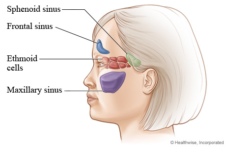 Where nasal sinus cavities are located (side view).