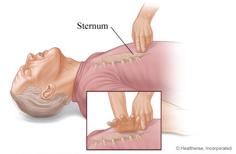 Where to place hands on sternum for chest compressions