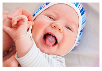 white coated tastebuds and dimpled pull down indicate restrictive form and function affected by tongue tie