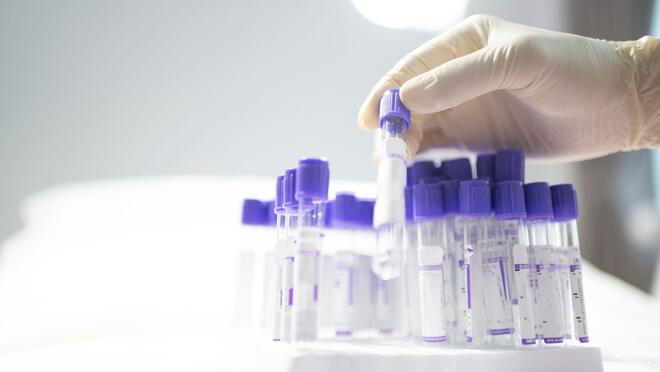 Gloved hand holding a viall in medical lab setting