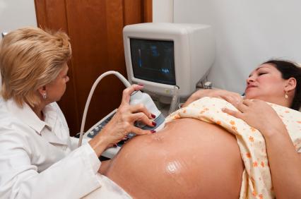 doctor performing an ultrasound on pregnant woman