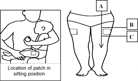 Illustration showing where on leg to apply numbing creams or patches from standing or sitting positions.